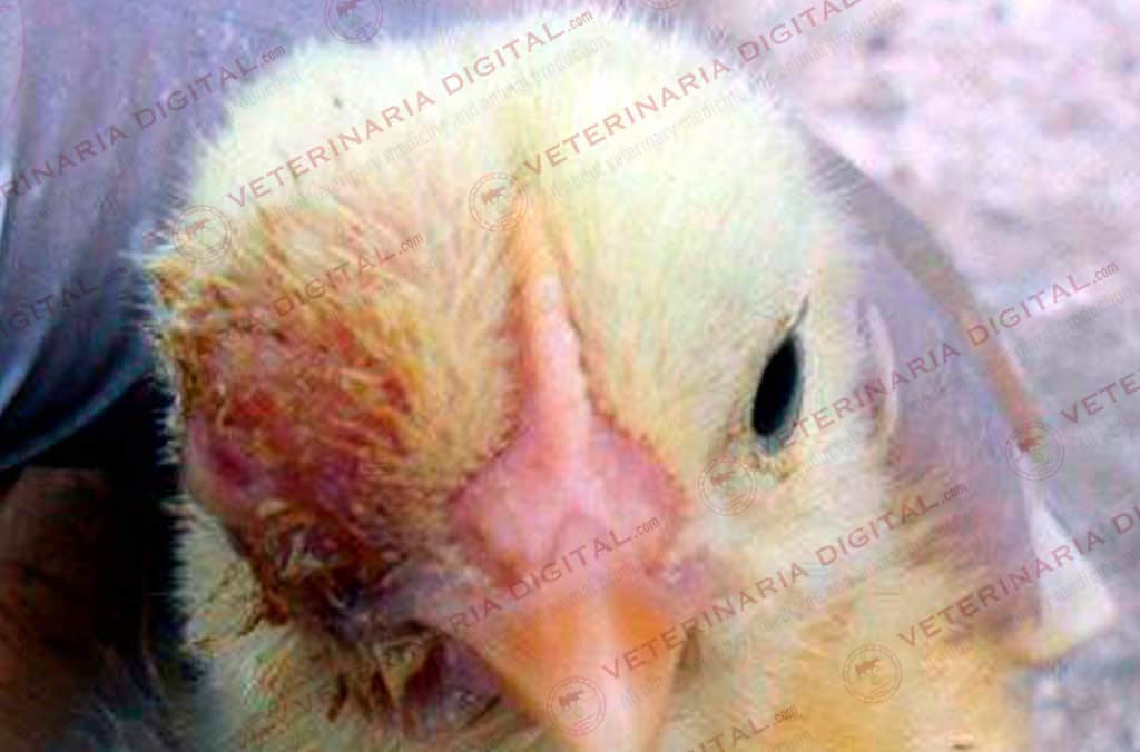 Aspergilosis ocular