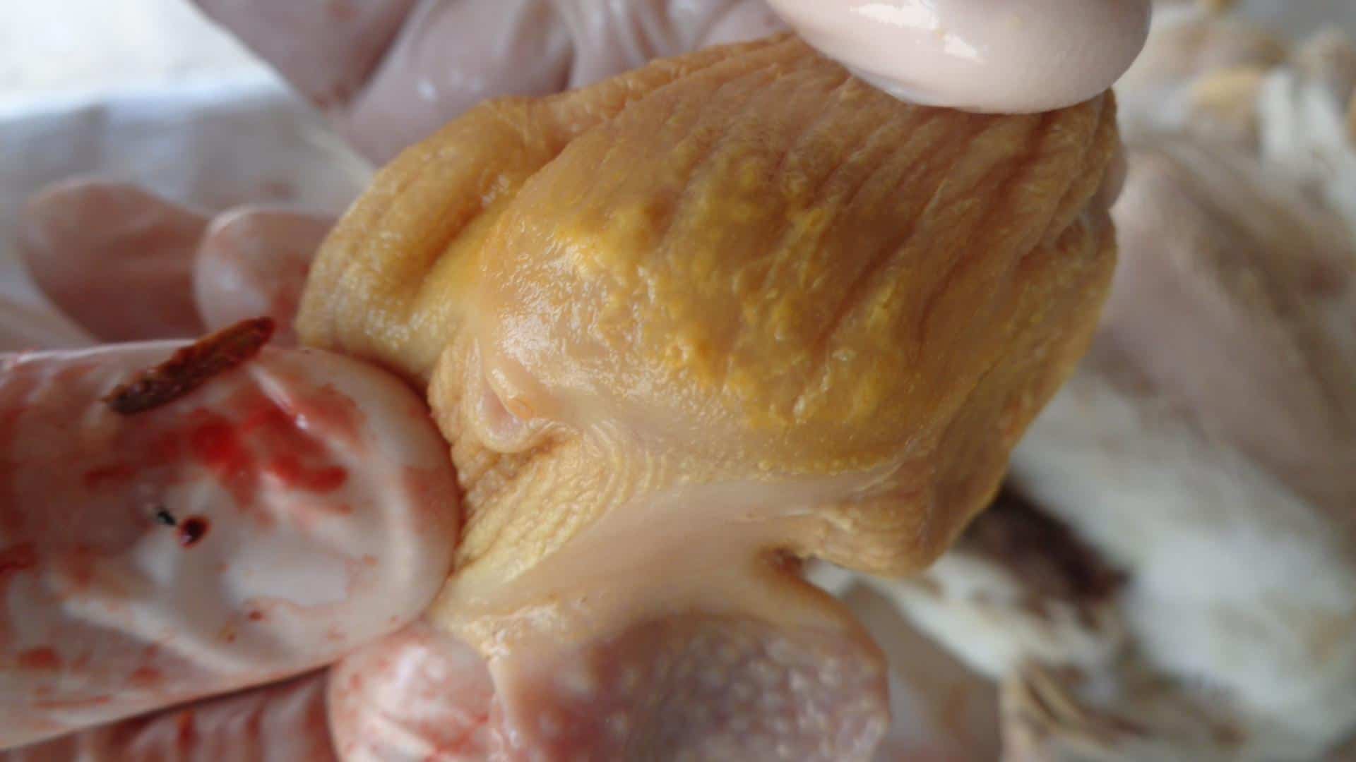 Micosis de molleja