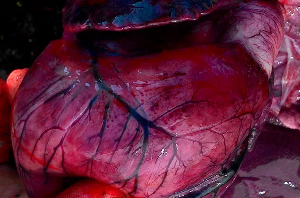 Pericarditis por salmonelosis porcina