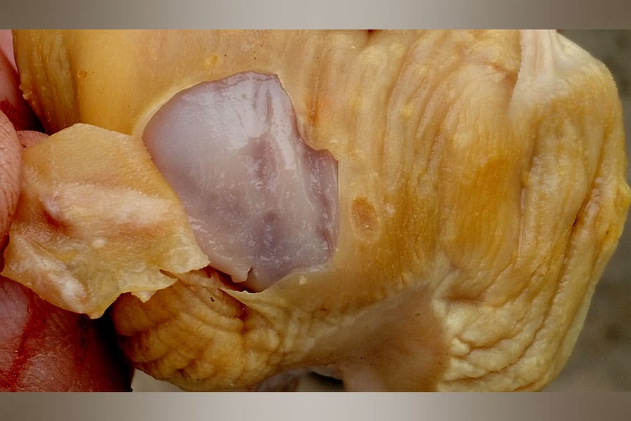 Micosis de molleja