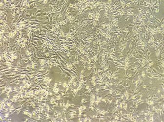 Enteritis necrótica in vitro