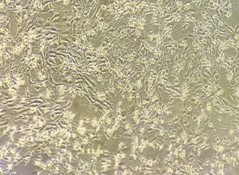 In vitro necrotic enteritis