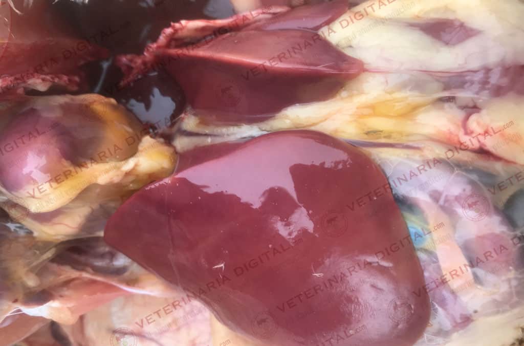 Infección por Shigella en hígado