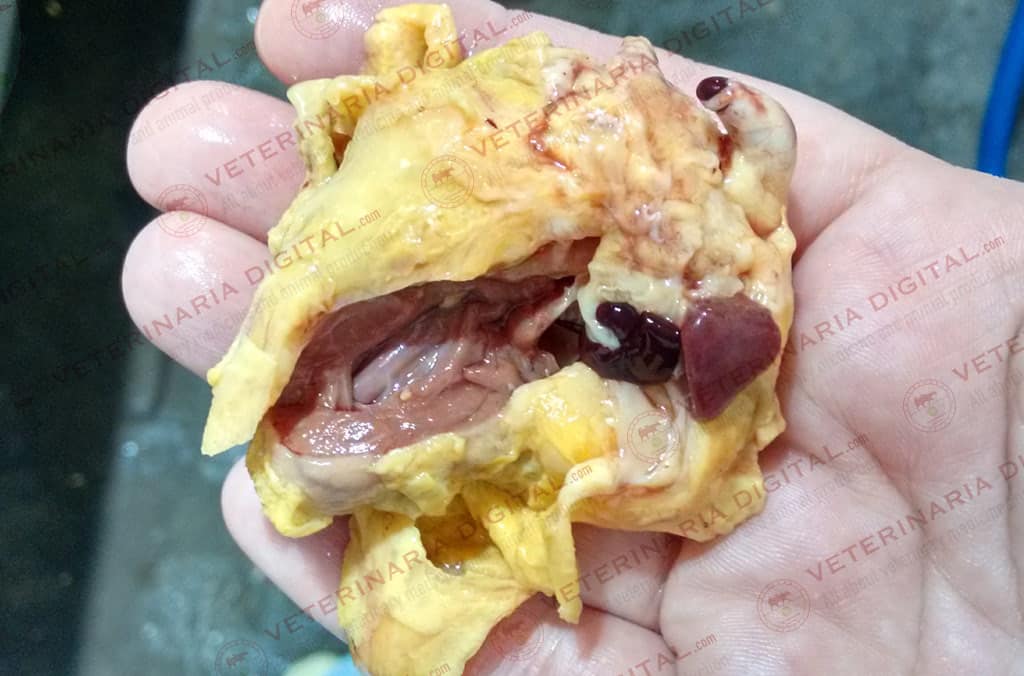Pericarditis septicémica