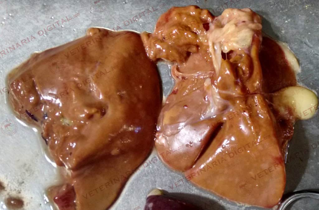 Sindrome de hígado graso