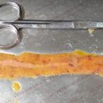 Placas de peyer y coccidia